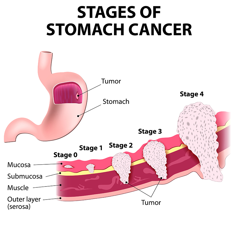 Stomach Diagnosis Chart