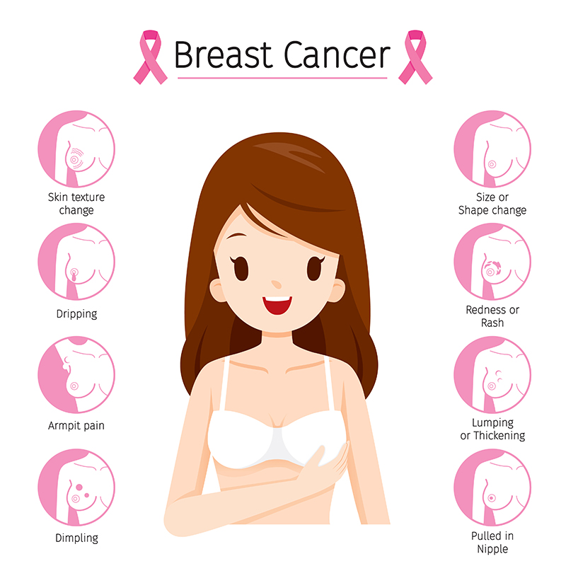 Breast Cancer Causes Symptoms and Treatment in Bangalore