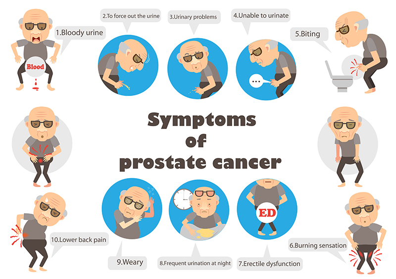 Prostate-Cancer-Treatment-Bangalore